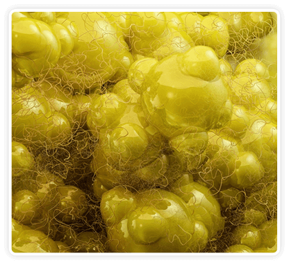 What Is Thermogenesis?